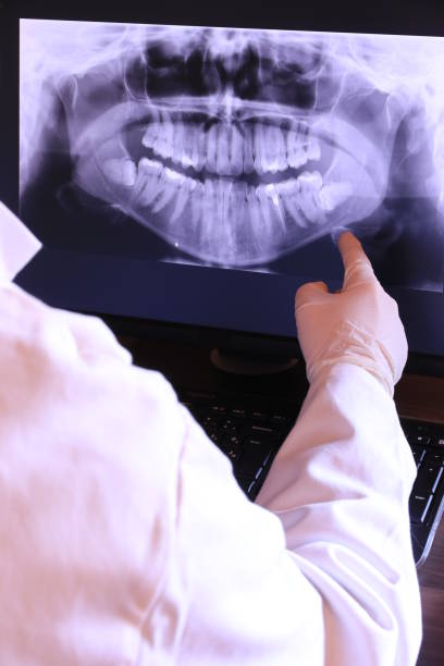 Best Emergency Treatment for Dental Infections or Abscesses in Palm Beach Gardens, FL
